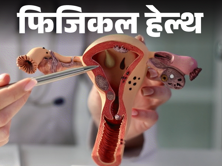 Uterine Fibroids Symptoms; Reasons & Risk Factors