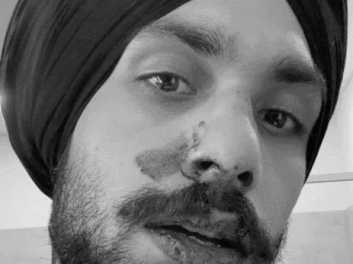 ऑस्ट्रेलिया में सिख युवक को इंडियन डॉग कहा:ऑस्ट्रेलियाई युवकों ने जिम के बाहर घेरा, 'वापस जाओ' के नारे लगाए; नाक की हड्डी तोड़ी