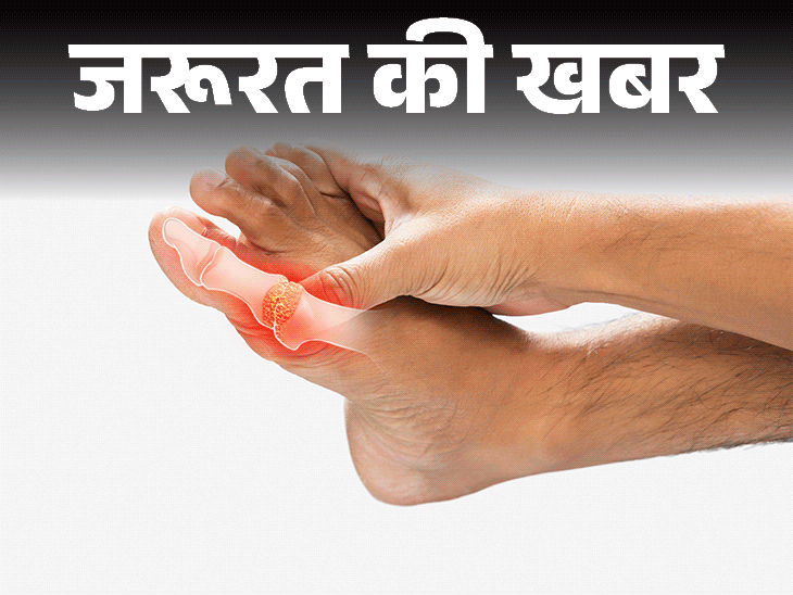 जरूरत की खबर- क्या आपका यूरिक एसिड बढ़ा है:इन 9 संकेतों से पहचानें, जानें बिना दवाई कैसे करें कंट्रोल, क्या खाएं और क्या न खाएं