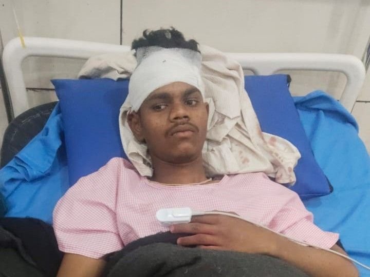 धार में जर्जर स्कूल भवन की छत गिरी:सोनगढ़ गांव में 5 बच्चे घायल, 2 साल से जर्जर स्थिति में है ब्लिडिंग