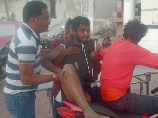 अनूपपुर में हाथी का हमला, युवक घायल:खेत में काम करते समय सूंड से पटका; सीएचसी कोतमा में भर्ती