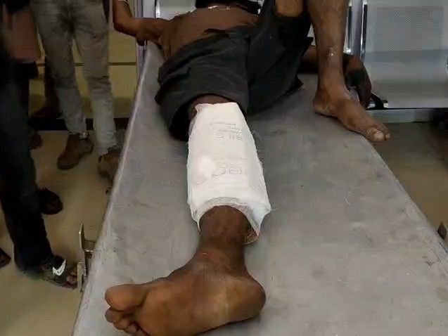 अटरिया मोड़ पर बुलेट फिसलने से युवक घायल:हादसे के बाद बोलेरो ले जाने पर विवाद; पुलिस ने अस्पताल पहुंचकर शांत कराया मामला