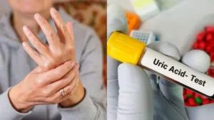कम यूरिक एसिड की समस्या