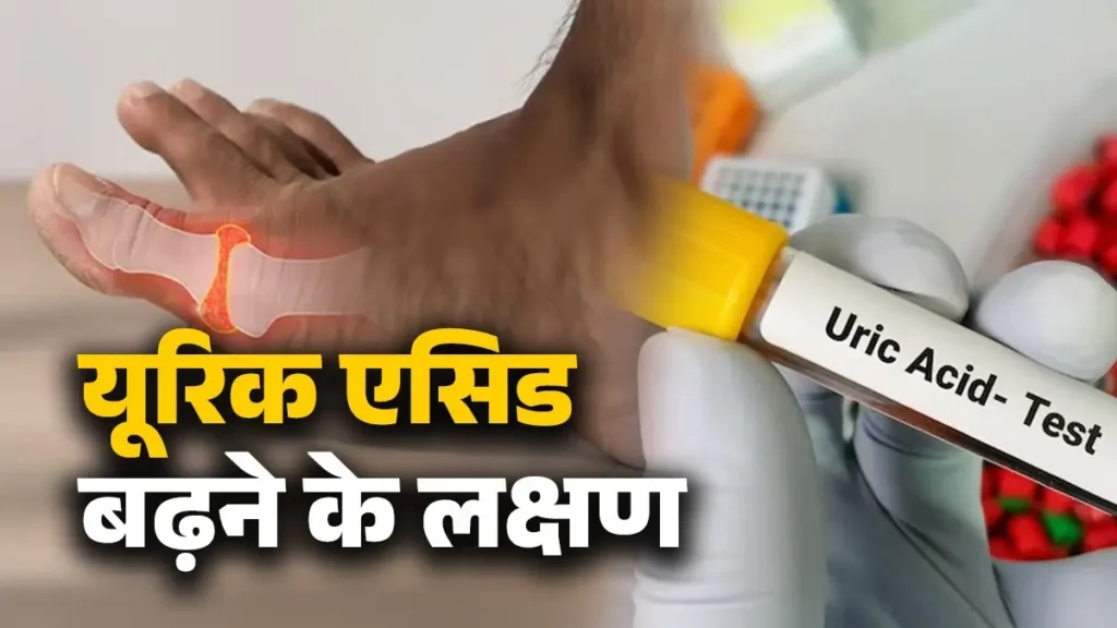 यूरिक एसिड के लक्षण या संकेत, जानिए यूरिक एसिड को नियंत्रित करने के लिए स्वस्थ जीवनशैली आहार युक्तियाँ