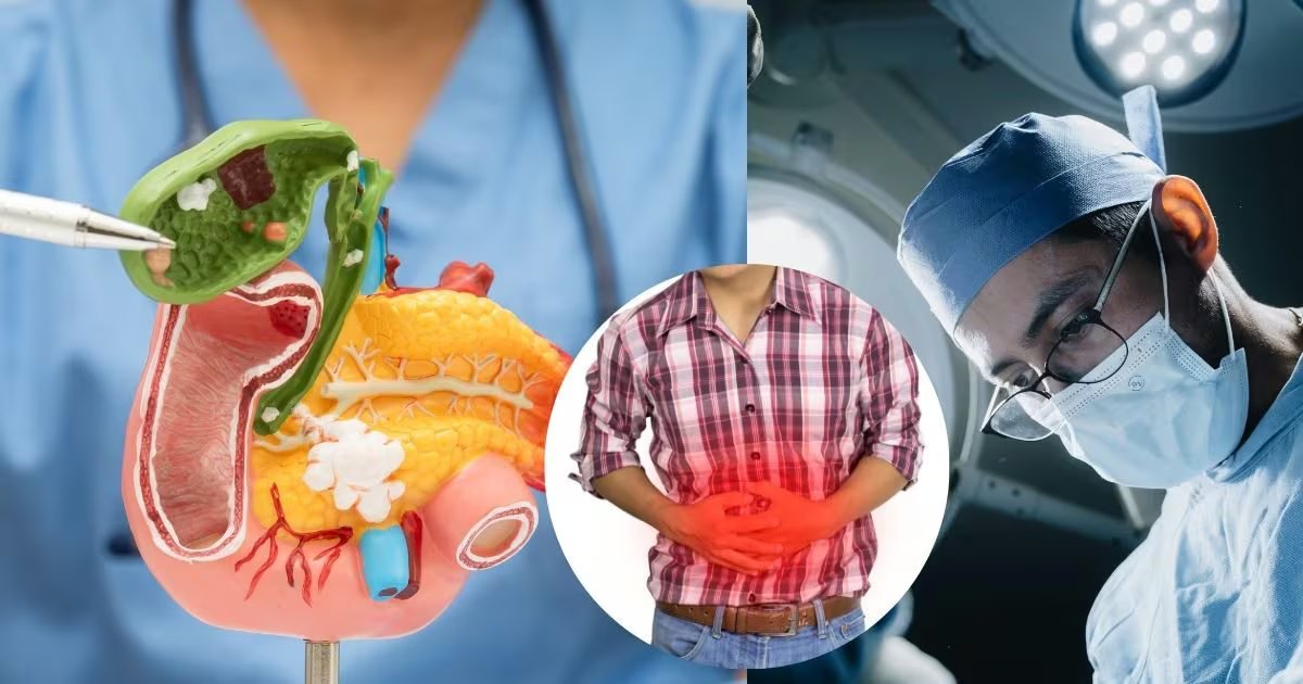 Gallbladder Stone Symptoms: पित्त की पथरी का दर्द कहां होता है? गालब्लैडर स्टोन के इस लक्षण को न करें नजरअंदाज, करवाना पड़ जाएगा ऑपरेशन