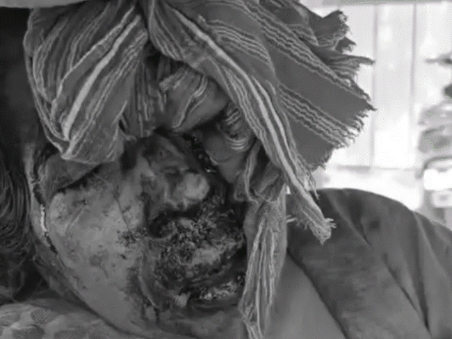 भोपाल में घर में घुसकर बुजुर्ग महिला से लूट:आरोपी ने बुजुर्ग के चेहरे पर पत्थर से किए वार, कान से बाली नोची, बेसुध हुई