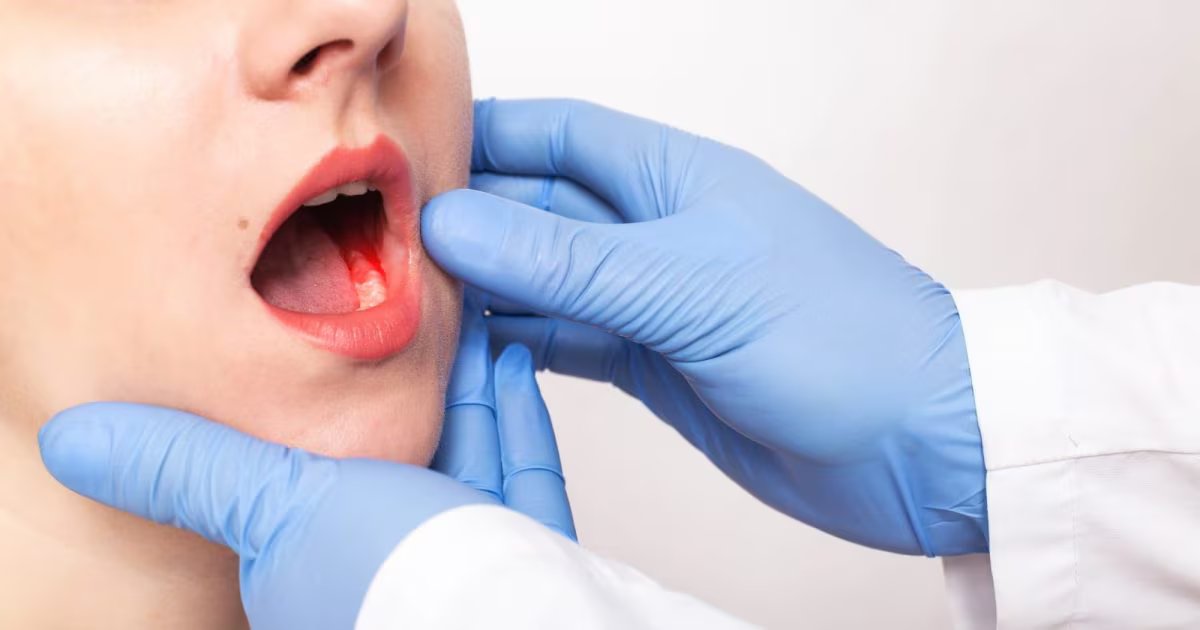 Oral Cancer Symptoms : कहीं आप भी तो नहीं कर रहे इन लक्षणों को नज़रअंदाज़? ये 6 बदलाव हो सकते हैं मुंह के कैंसर का संकेत!