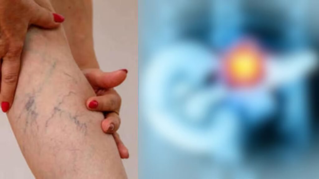 आंखों या त्वचा का पीला पड़ना, भूख कम लगना, तेजी से वजन घटना, पेट दर्द या मल त्याग में बदलाव जैसे संकेत भी अग्नाशय कैंसर से जुड़े हो सकते हैं.