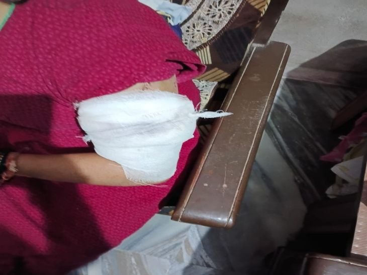 ग्वालियर में बेटे ने मां में मारा चाकू, घायल:खाना मांगा था, मां ने कहा- अभी देती हूं, देर हुई तो गुस्से में कर दिया हमला