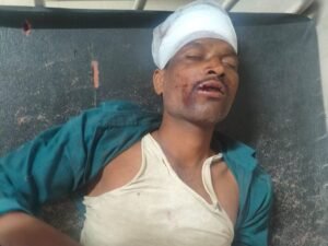 दो बाइक की टक्कर, तीन घायल:एक माइक्रो फाइनेंस कंपनी में काम करता, दो युवक सर्राठे मलाजखंड की ओर से बालाघाट आ रहे थे