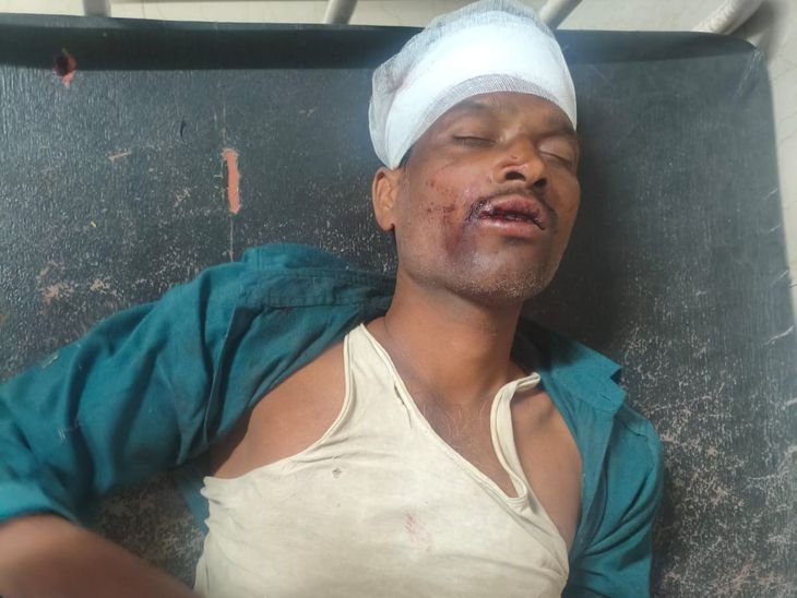 दो बाइक की टक्कर, तीन घायल:एक माइक्रो फाइनेंस कंपनी में काम करता, दो युवक सर्राठे मलाजखंड की ओर से बालाघाट आ रहे थे