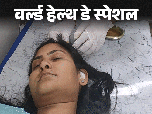 Leech Therapy for Skin Infections & Hair Loss