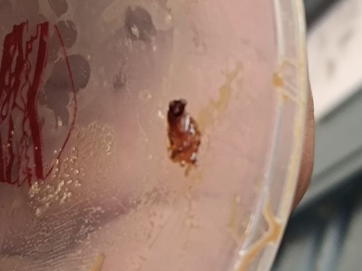 जोमैटो से मंगाई कोल्ड कॉफी में कॉकरोच निकलने का दावा:देवास में ग्राहक बोला- भाई की तबीयत बिगड़ गई, दुकानदार ने कहा-हमने कोई लापरवाही नहीं की