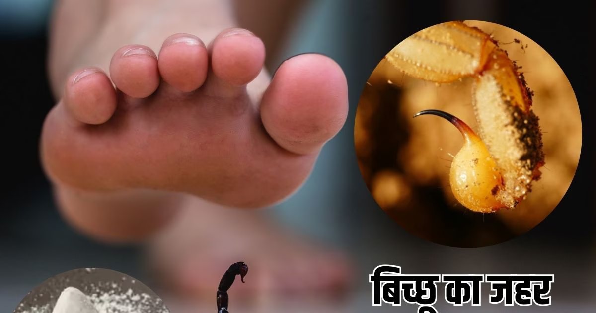 Tips To treat scorpion poisoning: तुरंत उतर जाएगा बिच्छू का जहर, करें ये 5 रामबाण उपाय