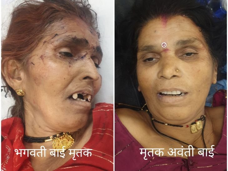 पचोर के पास सड़क हादसा, दो महिला की मौत:पिकअप-ट्रक भिड़ंत में 20 घायल, 6 इंदौर रेफर; अस्पताल में घायलों का इलाज जारी