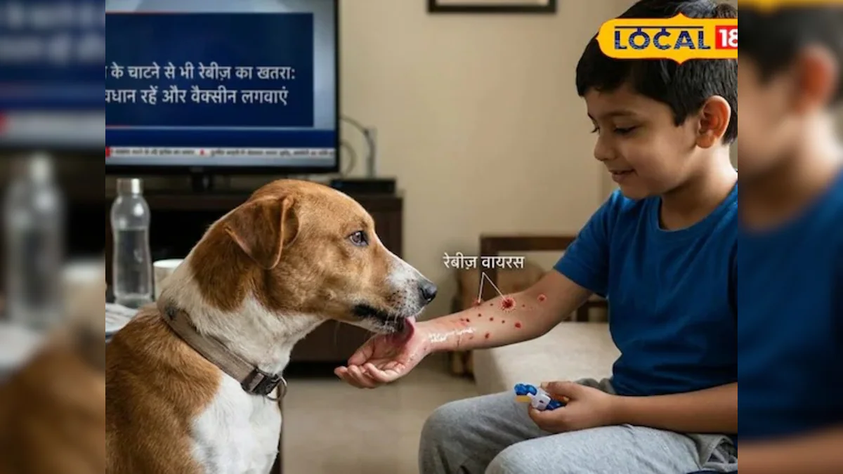 सिर्फ काटना ही नहीं, कुत्ते का 'चाटना' भी दे सकता है खौफनाक मौत! जानें डॉक्टर की चेतावनी – News18 हिंदी