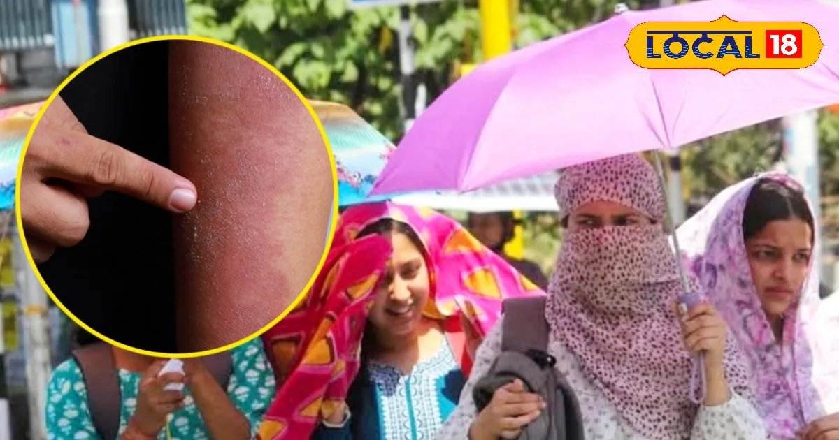 Skincare Tips: धूप से खराब हो रही स्किन? आसान घरेलू उपायों से मिलेगा नैचुरल ग्लो और पूरी सुरक्षा