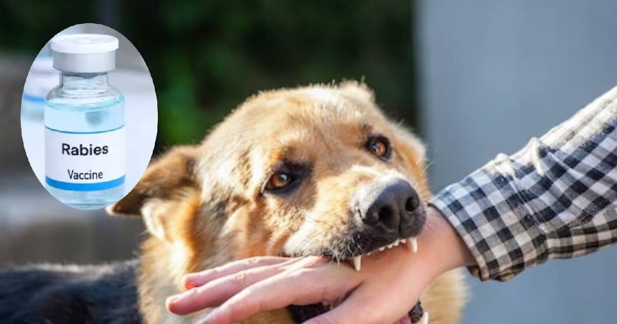 Anti rabies vaccine| ARV dose| dog bite| कुत्ता काटने के कितने घंटे के अंदर वैक्सीन लगवानी चाहिए? कितनी डोज हैं जरूरी, ये 5 सवाल में जानें गाइडलाइंस