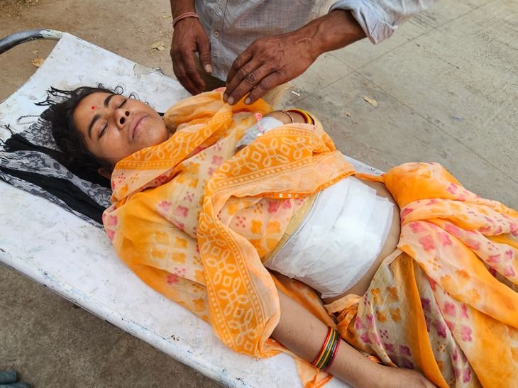 भूसे पर बाइक चढ़ाने के विरोध करने पर गोली मारी:महिला को छतरपुर जिला अस्पताल लाए परिजन; आरोपी फरार