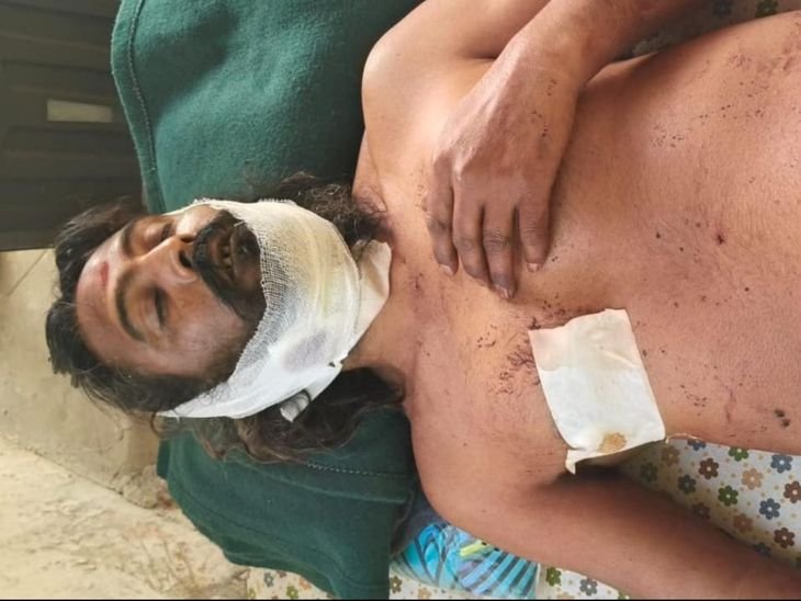 ग्वालियर में मंदिर की गद्दी को लेकर खूनी संघर्ष:पूर्व पुजारी हरिदास बाबा के चेलों में चले लाठी-डंडे और चाकू,योगेंद्र दास महाराज को गंभीर चोट