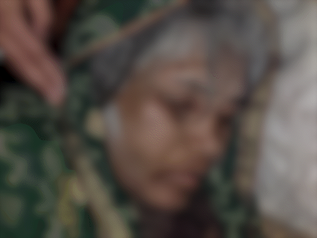 भोपाल में चलती कार से महिला को फेंका:सीने में चुभे थे स्टेप्लर पिन, खून से लथपथ मिली; अस्पताल में 22 घंटे से बेहोश