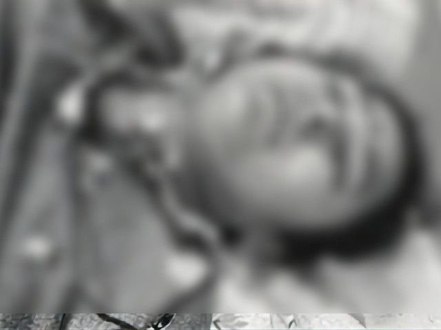 विवाहिता ने एसिड पिया, दस दिन बाद मौत:पारिवारिक विवाद के बाद बैतूल, भोपाल, नागपुर में चला इलाज