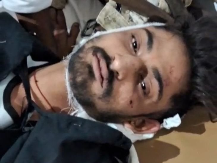 बारात के बीच गाड़ी निकालने पर विवाद:सतना में साइड मांगने पर 24 वर्षीय युवक को मारी गोली; कट्टे से किया फायर