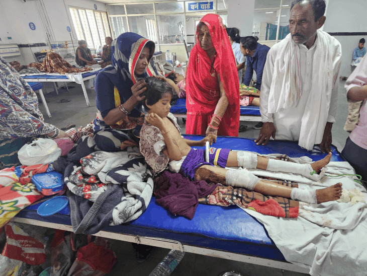 छतरपुर में बंदर के हमले से रिक्शा पलटा:9 साल की बच्ची का पैर फ्रैक्चर; ऑपरेशन के बाद ट्रॉमा वार्ड में भर्ती