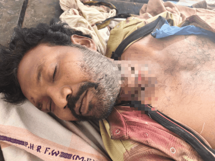 बैतूल में 7 नाबालिग निकले युवक की हत्या के आरोपी:मां से बात करने पर बेटों ने रची साजिश, चाकुओं से गोदा, लाश सड़क किनारे फेंकी