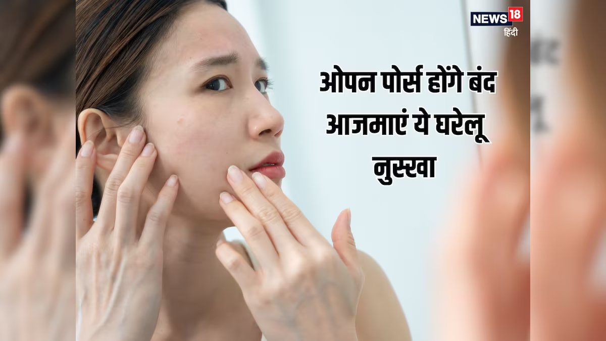 कम उम्र में स्किन पर नजर आ रहे ओपन पोर्स, स्टेप बाई स्टेप फॉलो करें ये घरेलू नुस्खा, पाएं दमकती त्वचा