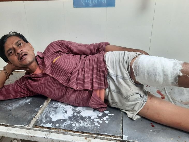 चंबल नदी किनारे शराब पार्टी में विवाद:कहासुनी के बाद चलाई गोली, युवक के पैर में दो गोली लगी, गंभीर हालत में जिला अस्पताल रेफर