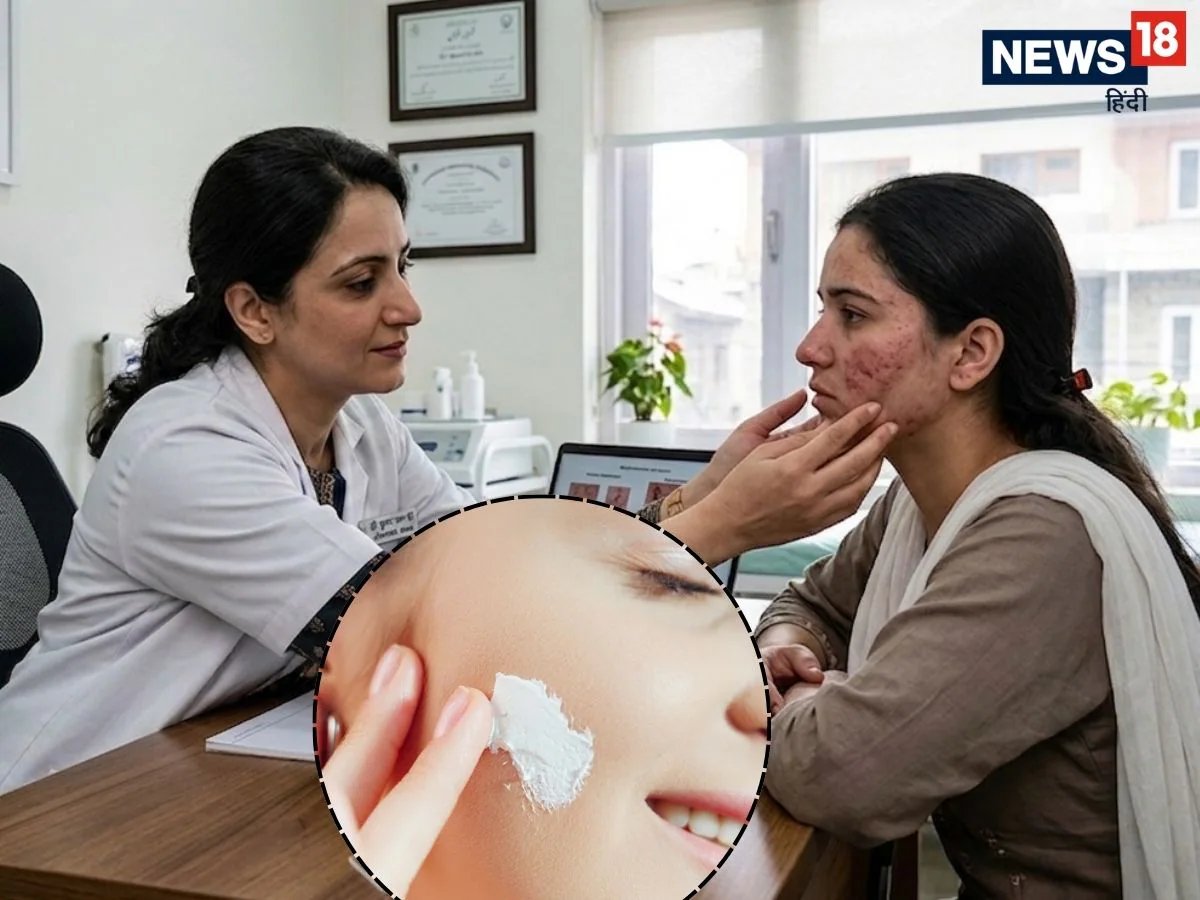 गोरी रंगत का लालच पड़ा भारी! 15 साल स्टेरॉयड क्रीम लगाने से डैमेज हुई स्किन, डॉक्टर ने बताया इसे रोकने का सही तरीका