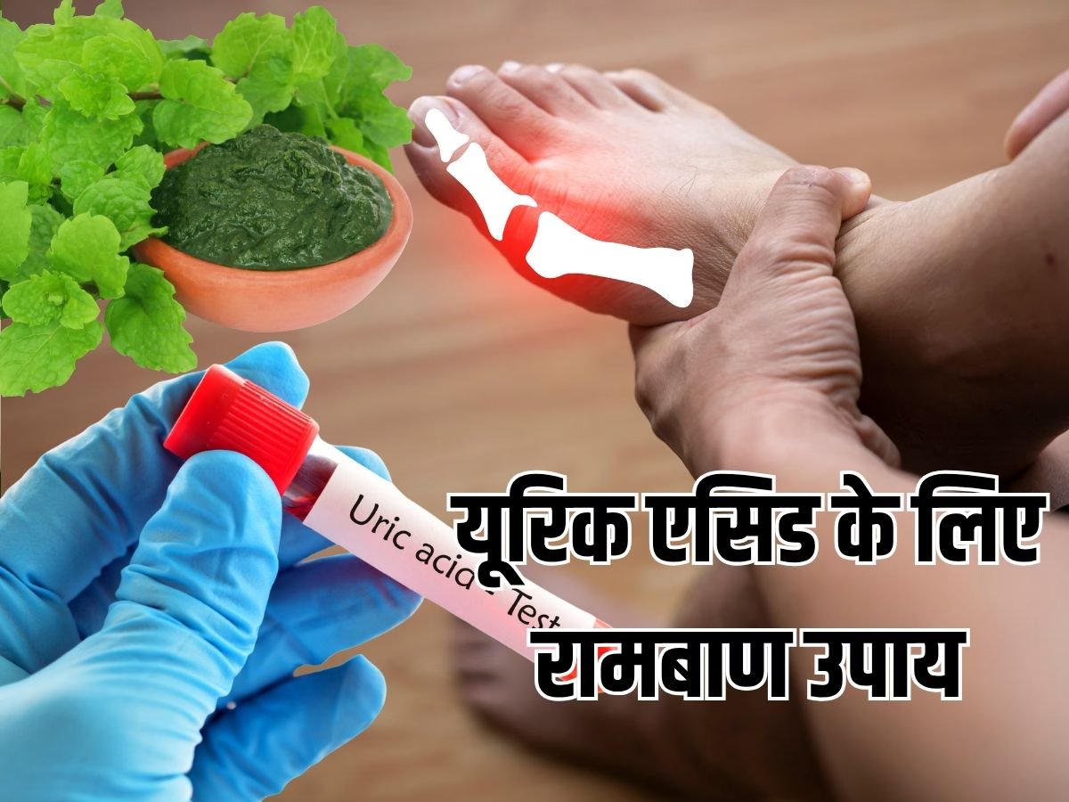 Uric Acid Home Remedy: यूरिक एसिड कंट्रोल करने का रामबाण उपाय, धनिया पत्ते की चटनी