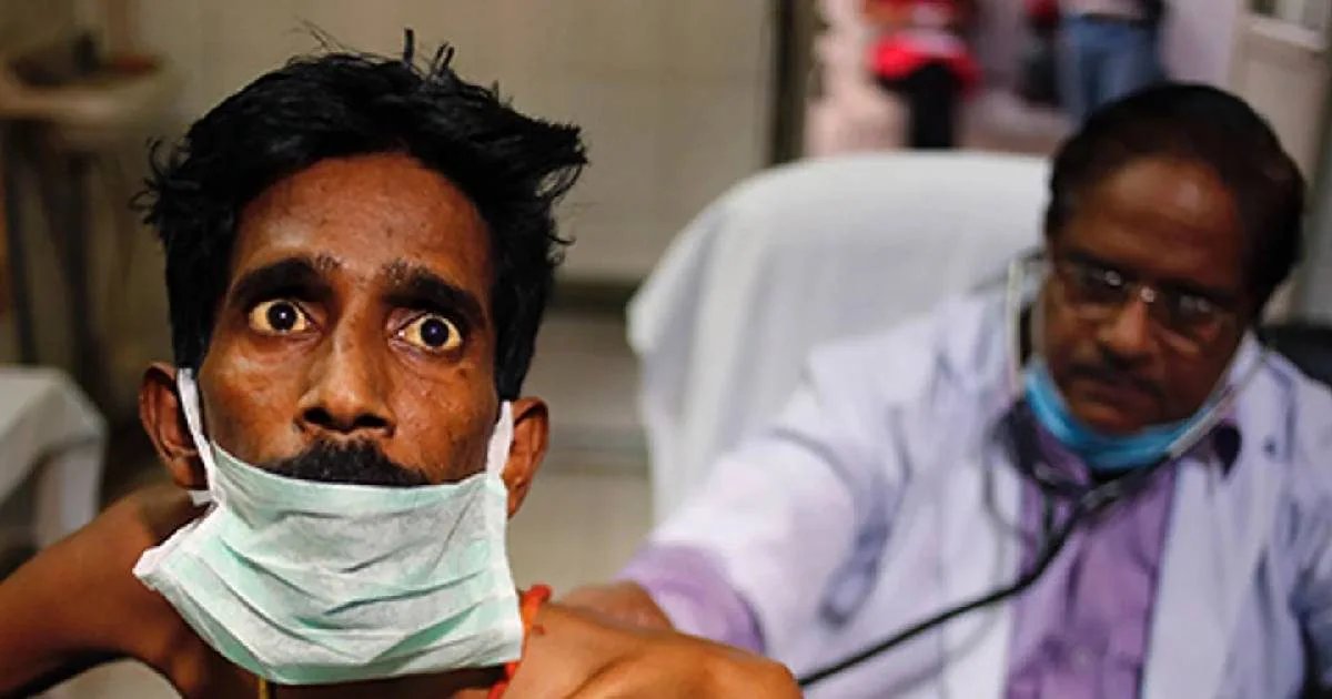 Delhi TB outbreak| delhi TB patient| TB in delhi| दिल्ली में टीबी विस्फोट! डेढ़ महीने में मिले 12 हजार मरीज, अभी और कितने?