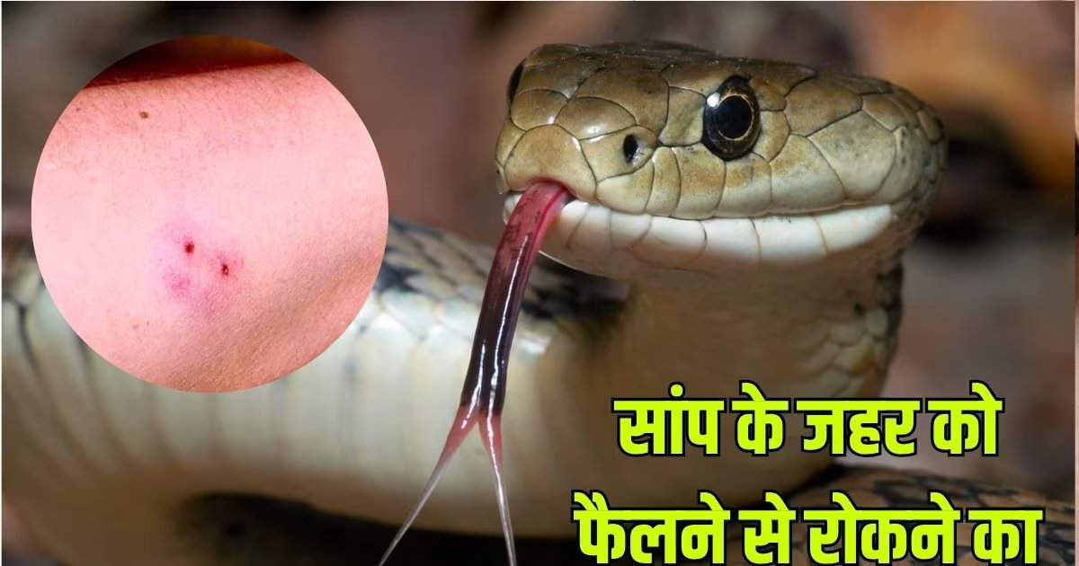 First Aid For A Snakebite: सांप के काटने पर जहर को शरीर में फैलने से रोकने का उपाय