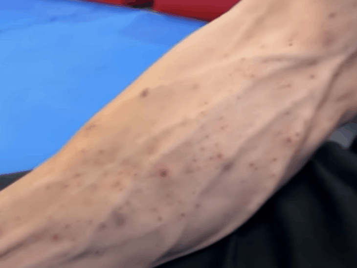 Tiger Shroff Injury Video | Juhu Firing Incident Update